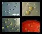 bacteria images with description